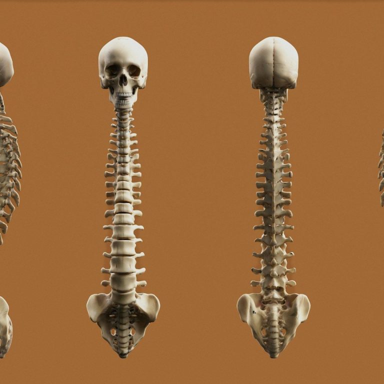 Assessing the source of pain