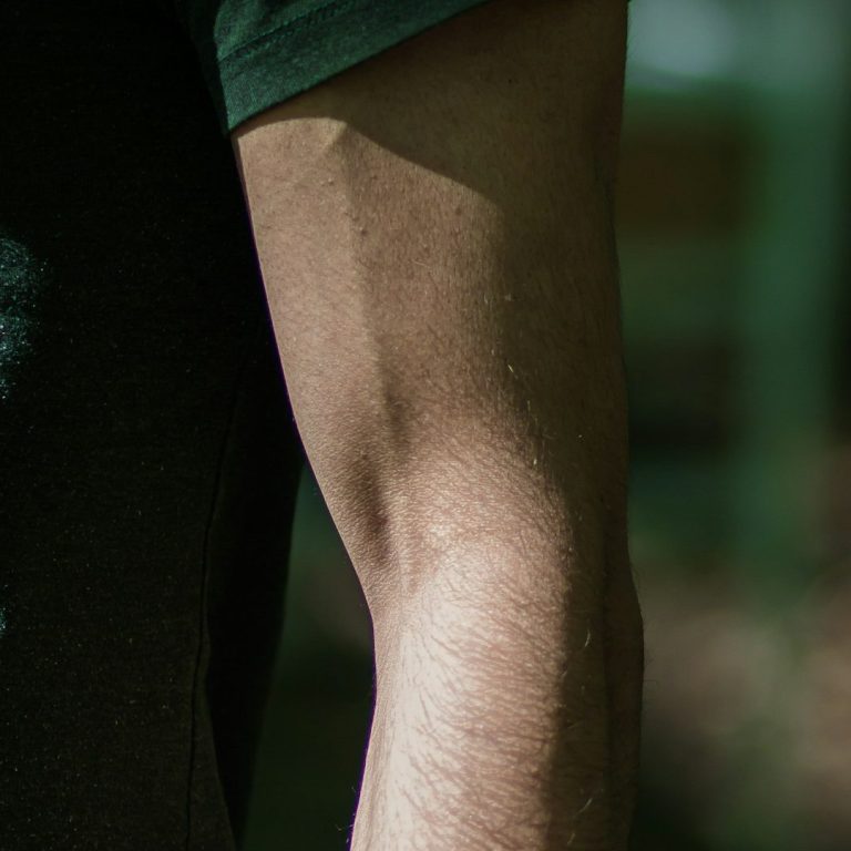 Elbow pain