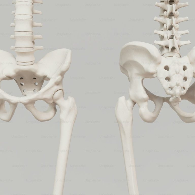 Hip bursitis