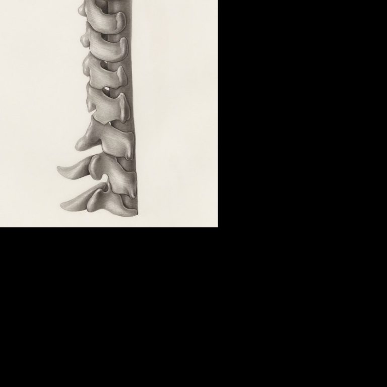 Neck pain & headaches
