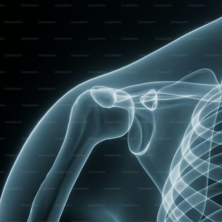 Shoulder rehabilitation