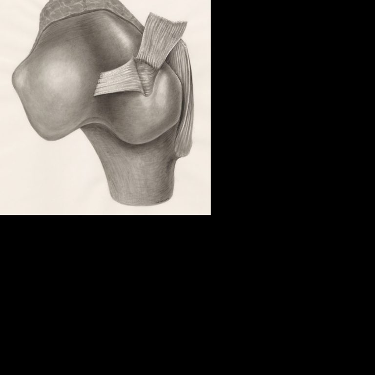 Rotator cuff